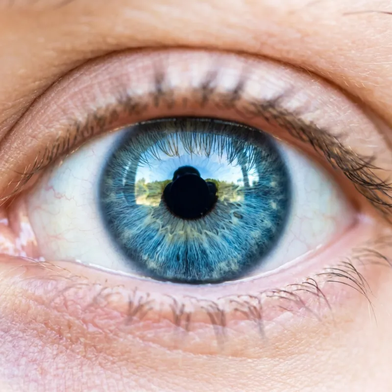 LASIK Vision Correction